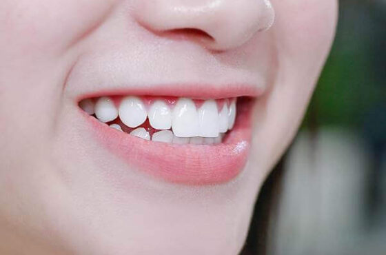 Làm răng sứ có gây hôi miệng không? Nguyên nhân và cách phòng ngừa hiệu quả